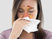 Registra Puebla aumento en casos de rinitis por caída de ceniza: Salud